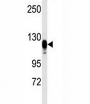 Western blot testing of mouse kidney tissue lysate with EGF Receptor antibody.