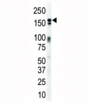 HER3 Antibody Mouse Brain WB. Western blot analysis of mouse brain lysate using HER3 Antibody / ERBB3 Tumor Signaling Antibody detects a band at approximately 150â180 kDa, consistent with the predicted molecular weight of HER3 / ERBB3, which may appear as a broad band due to glycosylation.