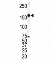 ERBB4 Antibody WB. Western blot analysis of ERBB4 antibody in T47D cell lysate. Protein lysates from human T47D breast carcinoma cells were resolved by SDS-PAGE under reducing conditions and probed with ERBB4 antibody. A prominent immunoreactive band is detected at approximately 150-160 kDa, consistent with the predicted molecular weight of the full-length HER4 precursor (147-180 kDa). Possible additional lower molecular weight bands at approximately 120 kDa and 80 kDa may represent proteolytically cleaved forms of ERBB4 generated through regulated intramembrane processing. The observed banding pattern aligns with known HER4 receptor processing and cleavage dynamics.