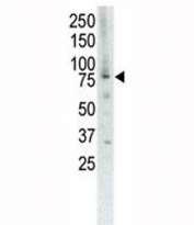 Western blot analysis of MUSK antibody and placenta cell lysate