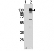 PDGFR Alpha Antibody Overexpression WB. Western blot analysis of non-transfected HEK293 cells (lane 1) and HEK293 cells transiently transfected with human PDGFRA (lane 2) using PDGFR Alpha Antibody / Receptor Tyrosine Kinase Antibody demonstrates a strong immunoreactive band at approximately 120-130 kDa in the transfected sample. Minimal to no signal is observed in the non-transfected control, supporting specific recognition of PDGFRA. PDGFRA is a receptor tyrosine kinase that mediates platelet-derived growth factor signaling and regulates cellular proliferation, migration, differentiation, and survival. The detected band is consistent with recombinant expression of human PDGFRA and supports the specificity of the antibody for the target protein. Predicted molecular weight: 120-195 kDa, depending on glycosylation status and receptor maturation.