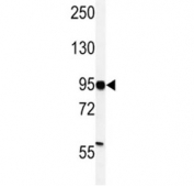 Western blot analysis of HIF-1 alpha antibody and MDA-MB231 lysate. Routinely observed molecular weight: 100~120 kDa.