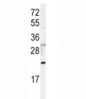Western blot analysis of HRAS antibody in Jurkat lysate. Predicted molecular weight ~21 kDa.