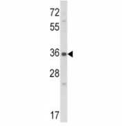Connective Tissue Growth Factor Antibody WB. Western blot analysis of NCI-H460 cell lysate using Connective Tissue Growth Factor Antibody demonstrates a distinct immunoreactive band at approximately 38 kDa. The observed molecular weight is consistent with the predicted size of Connective Tissue Growth Factor (CTGF), also known as Cellular Communication Network Factor 2 (CCN2), a secreted matricellular protein involved in extracellular matrix regulation, tissue remodeling, wound healing, and cellular signaling. The strong, discrete band supports specific recognition of CTGF in human cells and demonstrates the utility of this antibody for studies of fibrosis, connective tissue biology, tumor microenvironment interactions, and extracellular matrix remodeling pathways.