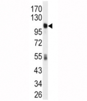 Western blot analysis of ALDH1L1 antibody and mouse liver tissue lysate.