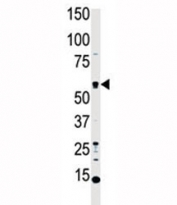 Western blot analysis of MST1 antibody and HL-60 cell lysate. Predicted molecular weight ~ 56 kDa.