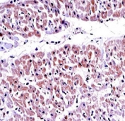 PTEN antibody immunohistochemistry analysis in formalin fixed and paraffin embedded human heart tissue.