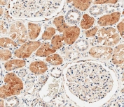 DUSP6 Antibody Human Kidney IHC. Immunohistochemical staining of FFPE human kidney tissue using DUSP6 antibody demonstrates strong cytoplasmic HRP-DAB brown staining within renal tubular epithelial cells, with comparatively weaker staining in surrounding stromal and glomerular structures. The staining pattern is consistent with expression of DUSP6 (Dual Specificity Phosphatase 6), a key negative regulator of ERK/MAPK signaling pathways. By dephosphorylating activated ERK proteins, DUSP6 helps modulate intracellular signaling responses involved in cellular differentiation, survival, growth factor signaling, and tissue homeostasis. The prominent tubular epithelial staining supports the role of DUSP6 in maintaining regulated MAPK pathway activity within metabolically active epithelial tissues. HIER: steam section in pH 9 EDTA for 20 minutes and allow to cool prior to staining.