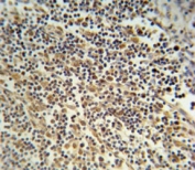 NLRP3 Antibody Lymph Tissue IHC. NLRP3 antibody immunohistochemistry analysis in formalin fixed and paraffin embedded human lymph tissue.