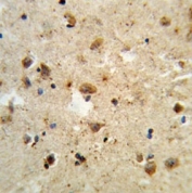 IHC analysis of FFPE human brain tissue stained with ATF6 antibody