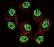 BMI1 Antibody MCF7 Cell IF. Confocal immunofluorescent analysis of BMI1 antibody with MCF-7 cells followed by Alexa Fluor 488-conjugated goat anti-rabbit lgG (green). Actin filaments have been labeled with Alexa Fluor 555 Phalloidin (red).