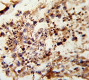 IHC analysis of FFPE human testis tissue stained with Acrosin antibody