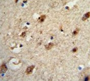 IHC analysis of FFPE human brain tissue stained with ACP1 antibody
