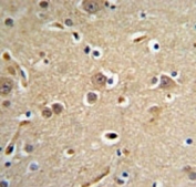 NEDD4 Antibody Human Brain IHC Neuronal Expression. Immunohistochemistry analysis of Neural precursor cell expressed developmentally down-regulated protein 4 / NEDD4 in FFPE human brain tissue using NEDD4 Antibody for IHC. HRP-DAB brown chromogenic staining demonstrates cytoplasmic localization in neuronal cell bodies with scattered distribution throughout the tissue, while surrounding neuropil shows lighter background signal. The staining pattern supports neuronal expression of NEDD4 within human brain tissue architecture.