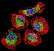 Vimentin Antibody / Neural Cytoskeleton Immunofluorescence Marker Antibody. Immunofluorescence analysis of Vimentin / VIM in human HeLa cells demonstrating strong cytoplasmic filamentous staining (green) consistent with neural-associated cytoskeletal organization and intermediate filament network distribution. The Vimentin Antibody / Neural Cytoskeleton Immunofluorescence Marker Antibody highlights extensive filament structures throughout the cytoplasm, with clear spatial separation from actin filaments labeled in red, emphasizing distinct cytoskeletal systems. Nuclei are counterstained with DAPI (blue), supporting high-resolution visualization of cytoskeletal architecture and filament organization in confocal imaging.