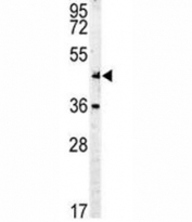 c-Myc antibody western blot analysis in mouse Neuro-2a lysate. Theoretical molecular weight: ~50 kDa but routinely observed at 50~70 kDa.