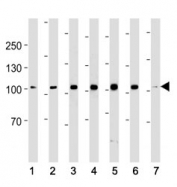 ACE2 antibody western blot analysis in (1) 293, (2) K562, (3) MCF-7, (4) SK-BR-3, (5) T47D, (6) MDA-MB-453 cell line and (7) mouse testis tissue lysate. Predicted molecular weight: 90-100 kDa.
