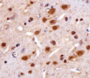 IHC analysis of FFPE rat brain section using Cdk4 antibody at 1:25.
