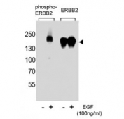 Phospho-ErbB2 (pY1221) Antibody EGF-Stimulated WB. Western blot analysis of human A431 cell lysates treated with or without EGF (100 ng/ml) using Phospho-ErbB2 (pY1221) Antibody demonstrates a band at approximately 185 kDa in EGF-stimulated samples, consistent with the predicted molecular weight of phosphorylated ErbB2 / HER2, while untreated samples show reduced signal; parallel detection with a non-phospho ErbB2 antibody confirms total receptor expression across conditions, supporting phosphorylation-dependent signaling at Tyr1221.