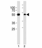 Western blot analysis of lysate from (1) A549 cell line and (2) rat liver tissue lysate using ALDH1A1 antibody diluted at 1:1000.