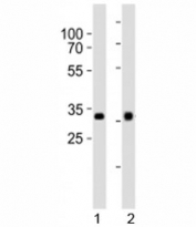 Western blot analysis of lysate from 1) HepG2 and 2) Y79 cell line using OTX2 antibody at 1:1000.