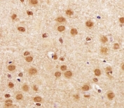 SIRT1 Antibody Mouse Brain IHC. Immunohistochemistry analysis of FFPE mouse brain section using SIRT1 antibody at 1:25.