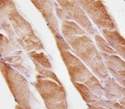Immunohistochemical analysis of paraffin-embedded mouse skeletal muscle using Musk antibody at 1:25 dilution.