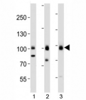 TLE1 Antibody / Wnt Signaling Corepressor western blot analysis of human cell lines and brain tissue. Lane 1: HepG2 cell lysate, Lane 2: MCF-7 cell lysate, Lane 3: human brain tissue lysate. Proteins were separated by SDS-PAGE and transferred to a membrane for immunoblot detection using TLE1 Antibody / Wnt Signaling Corepressor. A band is detected at approximately 83 kDa in each lane, consistent with the predicted molecular weight of Transducin-Like Enhancer Protein 1 (TLE1). The detected band represents endogenous expression of the Groucho family transcriptional corepressor involved in Wnt signaling mediated transcriptional repression and beta-catenin pathway regulatory complexes.