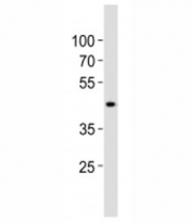 Western blot analysis of lysate from human kidney tissue lysate using SOX7 antibody diluted at 1:1000. Predicted molecular weight: 42/49 kDa (isoforms 1/2).