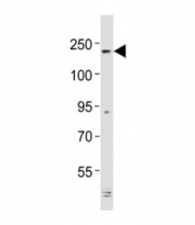 ALK Antibody Mouse Cerebellum WB. Western blot analysis of mouse cerebellum lysate using ALK antibody at 1:2000 dilution demonstrates a high molecular weight band migrating near 200-220 kDa, consistent with the predicted molecular weight range of Anaplastic lymphoma kinase / ALK. The observed signal supports expression of this receptor tyrosine kinase within neuronal tissue and aligns with the established role of ALK in nervous system-associated signaling pathways.