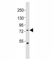 Western blot testing of FBXW7 antibody at 1:2000 dilution + HeLa lysate; Predicted molecular weight: 80 kDa (alpha), 70 kDa (beta).