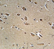 NGFR antibody immunohistochemistry analysis in formalin fixed and paraffin embedded human brain tissue.