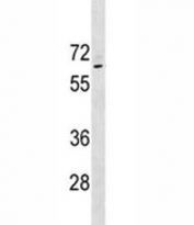 p63 Antibody K562 WB. Western blot analysis of K562 cell lysate using a p63 antibody as a nuclear transcription factor marker demonstrates detection of Tumor protein 63 (TP63) as a band within the expected range of approximately 63-77 kDa. The observed signal appears near ~70 kDa, consistent with TP63 isoforms commonly detected in cell lysates. The band is discrete with low background, supporting specific recognition of TP63 in denatured samples. The molecular weight position aligns with the role of TP63 as a nuclear transcription factor, and the clean banding pattern supports use of this p63 antibody for western blot analysis of TP63 expression and isoform detection.