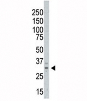 Western blot testing of AURKC antibody and A375 cell lysate. Predicted molecular weight ~ 33 kDa.