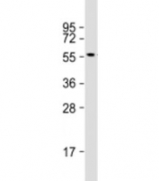 ETS1 Antibody MOLT4 WB. Western blot testing of human MOLT4 cell lysate with ETS1 antibody at 1:500. Predicted molecular weight: 51 kDa.