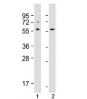 Western blot testing of human 1) Jurkat and 2) A431 cell lysate with SRC antibody at 1:1000. Predicted molecular weight: 60 kDa.