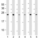 Western blot testing of 1) A549, 2) HCT116, 3) MCF-7, 4) NCI-H1299, 5) Raji and 6) THP-1 cell lysate with TPD52 antibody at 1:2000. Expected molecular weight: 20~26 kDa (isoforms 1-7).