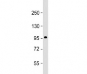 Western blot testing of human skeletal muscle lysate with SULF1 antibody at 1:2000. Predicted molecular weight: 101 kDa.
