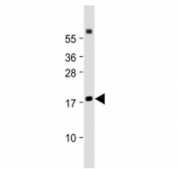 Western blot testing of Chemerin antibody at 1:2000 dilution + human lung lysate. Predicted molecular weight ~19 kDa.