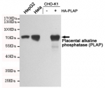 PLAP Antibody Multi-Cell Line WB. Western blot analysis of HepG2, HeLa, untransfected CHO-K1, and PLAP-transfected CHO-K1 cell lysates using PLAP Antibody detects a strong band at approximately 65-70 kDa in HepG2, HeLa, and PLAP-transfected CHO-K1 samples, while untransfected CHO-K1 cells show minimal signal. The observed banding pattern is consistent with expression of placental alkaline phosphatase / ALPP and supports specificity of this germ cell tumor marker antibody for PLAP-expressing cellular populations. The apparent molecular weight is consistent with the heavily glycosylated nature of this membrane-associated alkaline phosphatase family member.