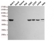 Vimentin Antibody for WB / VIM Western Blot Antibody. Western blot analysis of Vimentin / VIM in human cell line lysates showing band detection across multiple samples. Lane 1: Molt-4, Lane 2: Daudi, Lane 3: Ramos, Lane 4: Raji, Lane 5: K562, Lane 6: COS7, Lane 7: Jurkat, Lane 8: HeLa. A band is detected at approximately 55-60 kDa in Vimentin-positive cell lines (Molt-4, K562, COS7, Jurkat, HeLa), consistent with the predicted molecular weight of Vimentin / VIM. No band is observed in Vimentin-negative cell lines (Daudi, Ramos, Raji), confirming specificity. The Vimentin Antibody for WB / VIM Western Blot Antibody (clone 4F8-A5-H5) enables clear protein band detection and discrimination between positive and negative lysates under SDS-PAGE conditions.
