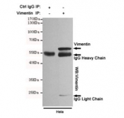 Vimentin Antibody HeLa Cell IP. Immunoprecipitation of Vimentin from HeLa cell lysate, and subsequent western blot testing, using Vimentin Antibody for WB / VIM Western Blot Antibody.