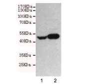 Neuron Specific Enolase Antibody SHSY-5Y and U87-MG WB. Western blot testing of human 1) SHSY-5Y and 2) U87-MG cell lysates using Neuron Specific Enolase antibody at 1:1000. Predicted molecular weight ~47 kDa.