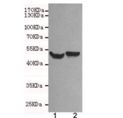 NSE Antibody Rat and Mouse Brain WB. Western blot testing of 1) rat brain and 2) mouse brain lysates using NSE antibody at 1:500. Predicted molecular weight ~47 kDa.