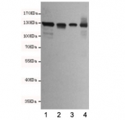 E-cadherin Antibody for WB. Western blot analysis of Cadherin 1 / CDH1 expression in human cell lysates: 1) T47D, 2) HCT116, 3) MDA-MB-468, and 4) Caco-2 using clone 6B10-F4-G10 antibody at 1:2000, showing bands near the predicted molecular weight of E-cadherin. E-cadherin is synthesized as a precursor and undergoes glycosylation, resulting in an apparent molecular weight typically observed between approximately 80-120 kDa, with the precursor form near 135 kDa. The detected bands are consistent with mature glycosylated E-cadherin across epithelial-derived cell lines, with variation in band intensity reflecting differences in expression levels.