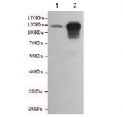 E-cadherin Antibody for WB in mouse embryo and human HCT116 cells. Western blot analysis of Cadherin 1 / CDH1 expression in 1) mouse embryo and 2) human HCT116 cell lysates using clone 6B10-F4-G10 antibody, showing bands near the predicted molecular weight of E-cadherin. E-cadherin is synthesized as a precursor and undergoes glycosylation, resulting in an apparent molecular weight typically observed between approximately 80-120 kDa, with the precursor form near 135 kDa. The detected bands are consistent with mature glycosylated E-cadherin, with stronger signal in HCT116 cells reflecting higher epithelial expression.