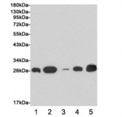 Western blot testing of human 1) MDA-MB-468, 2) ZR75-1, 3) MCF7, 4) T47D and 5) hamster CHO-K1 cell lysates using EIF4E antibody at 1:1000. Predicted molecular weight ~27 kDa.