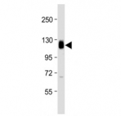 Thrombomodulin Antibody N-Terminus western blot testing at 1:2000 + human THP1 cell lysate. Expected molecular weight ~60/100 kDa (unmodified/glycosylated).