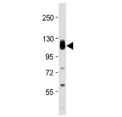Thrombomodulin Antibody C-Terminus western blot testing at 1:2000 + human THP1 cell lysate. Expected molecular weight ~60/100 kDa (unmodified/glycosylated).