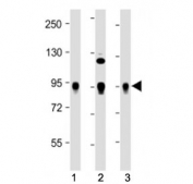 Western blot testing of Wee1 antibody at 1:2000: Lane 1) human HeLa, 2) Jurkat and 3) K562 cell lysate. Predicted molecular weight ~72 kDa.